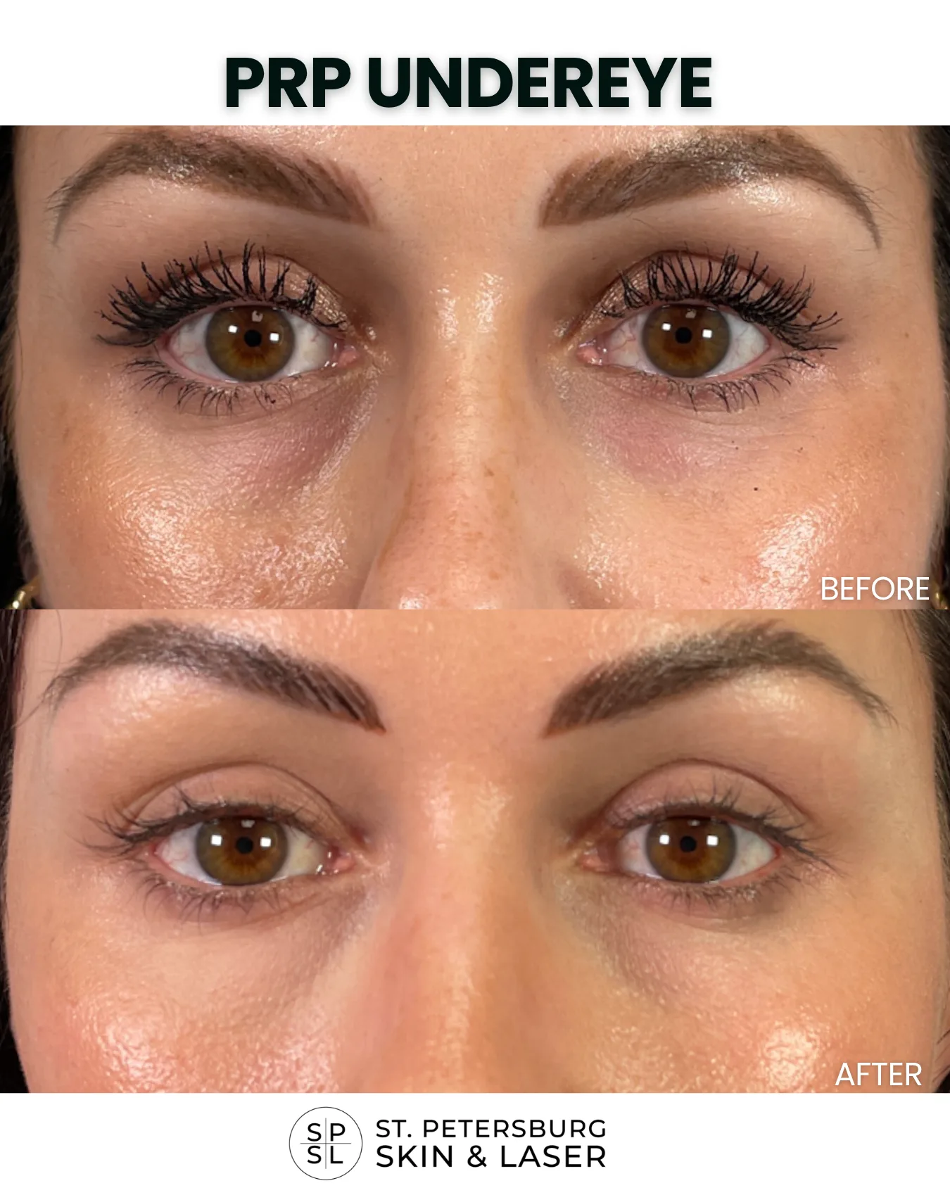 Treatment before and after results