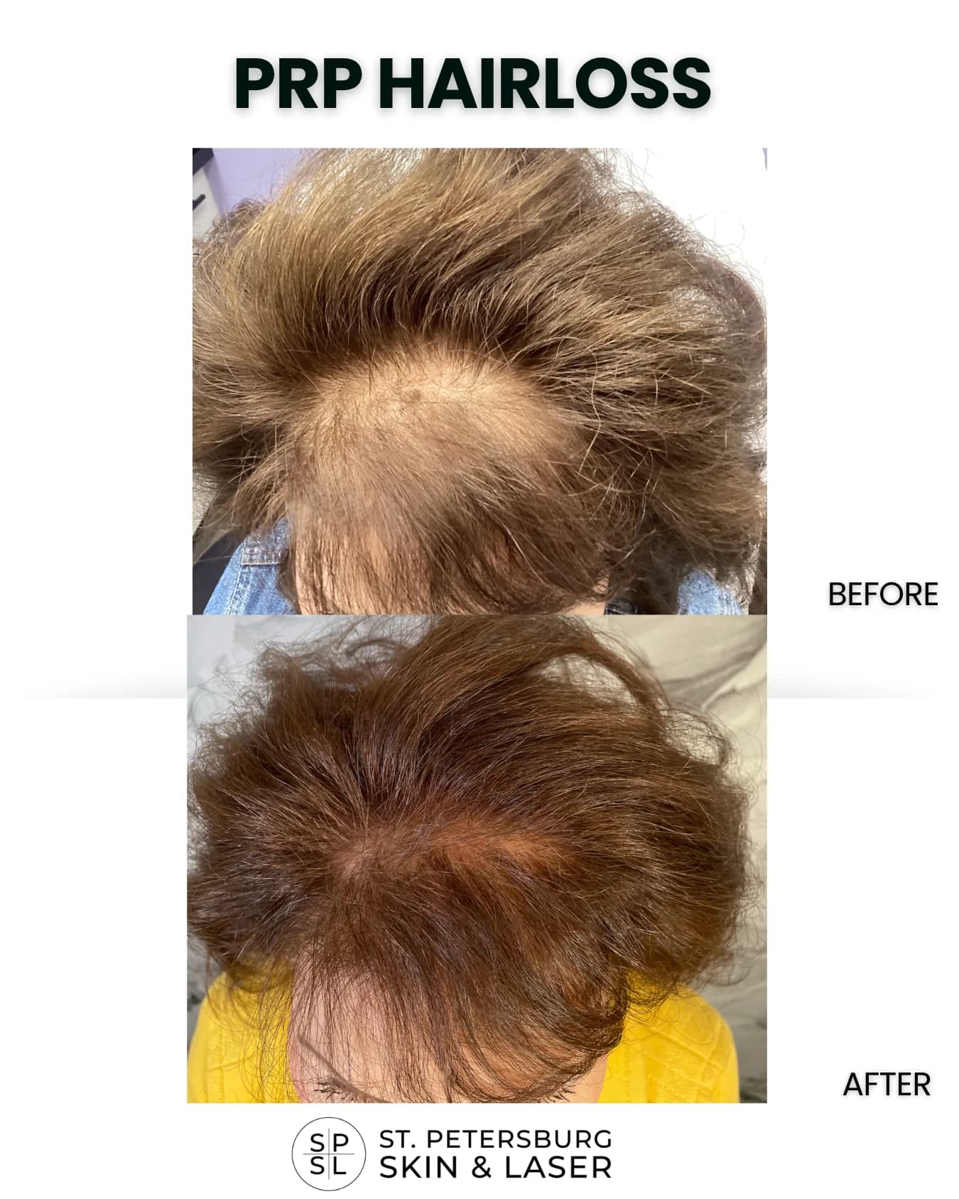 Treatment before and after results