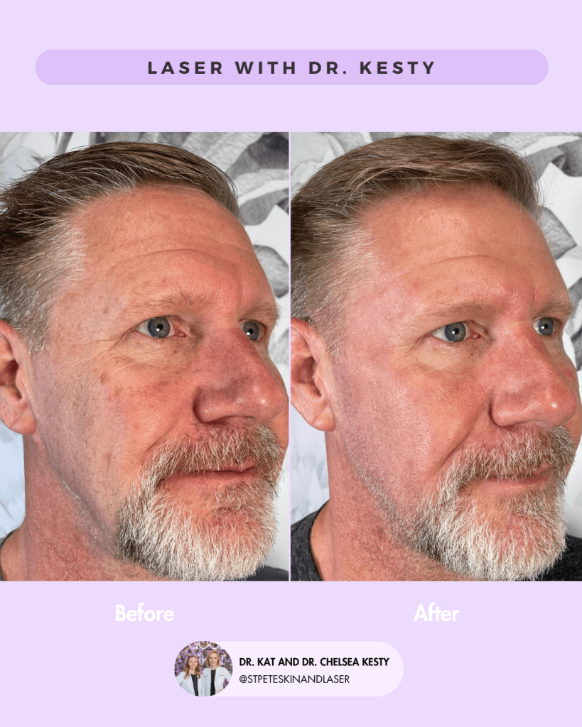 Other Cosmetic Procedures before and after results