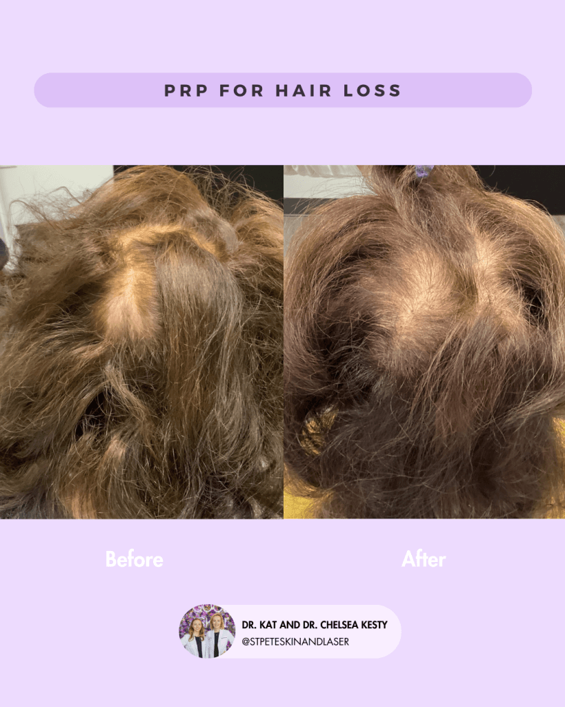 Other Cosmetic Procedures before and after results