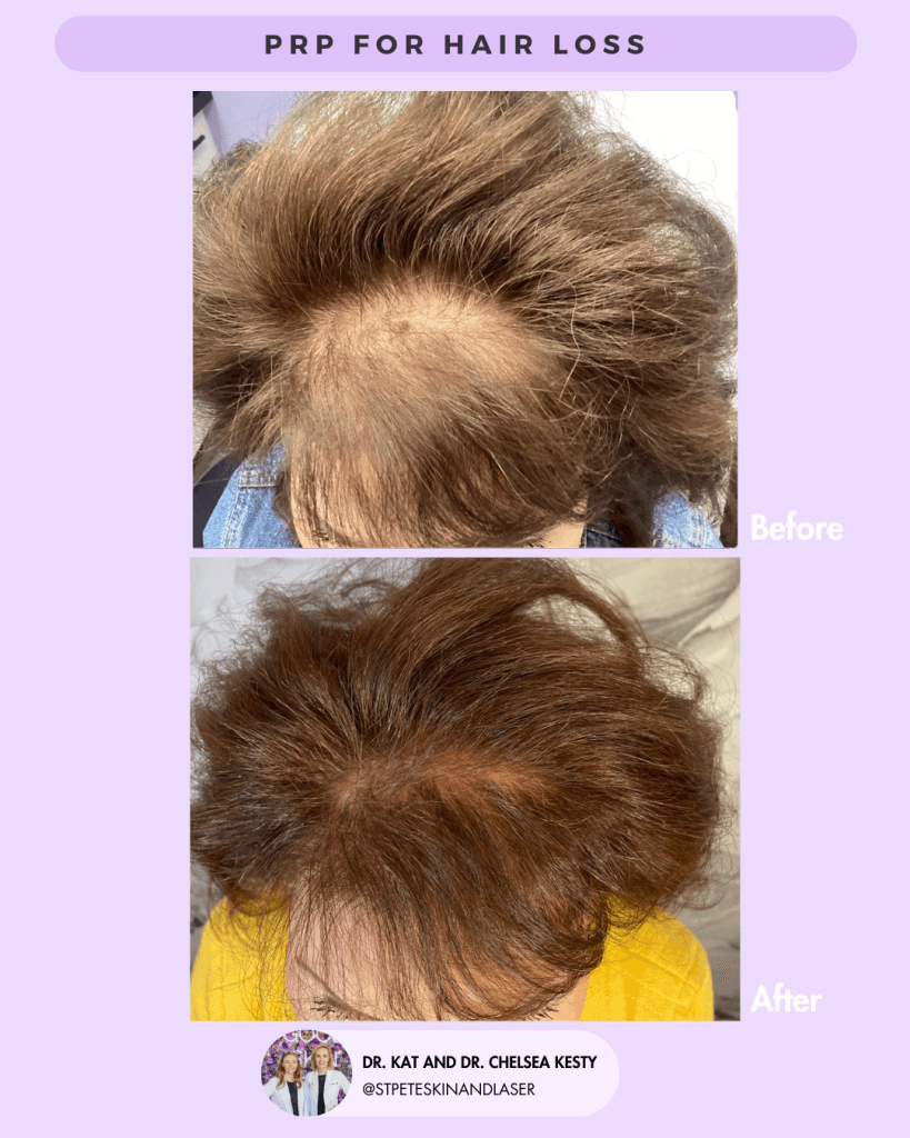 Other Cosmetic Procedures before and after results