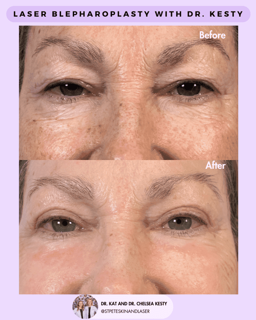 Other Cosmetic Procedures before and after results