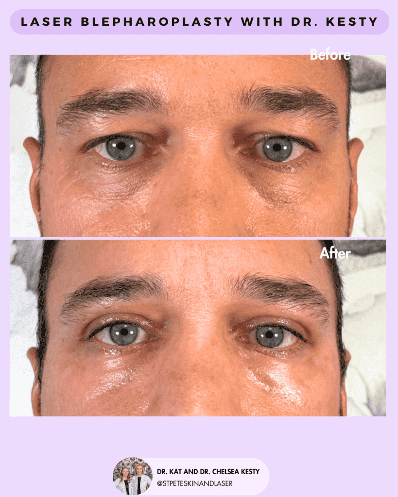 Other Cosmetic Procedures before and after results