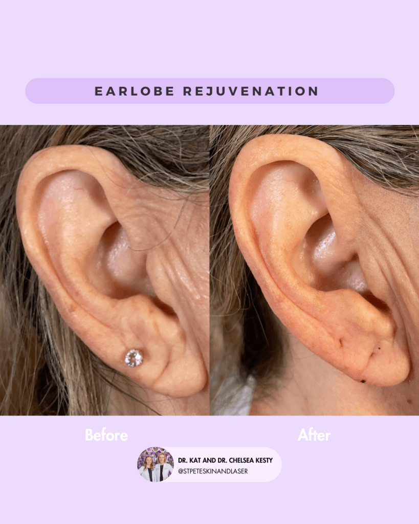 Other Cosmetic Procedures before and after results