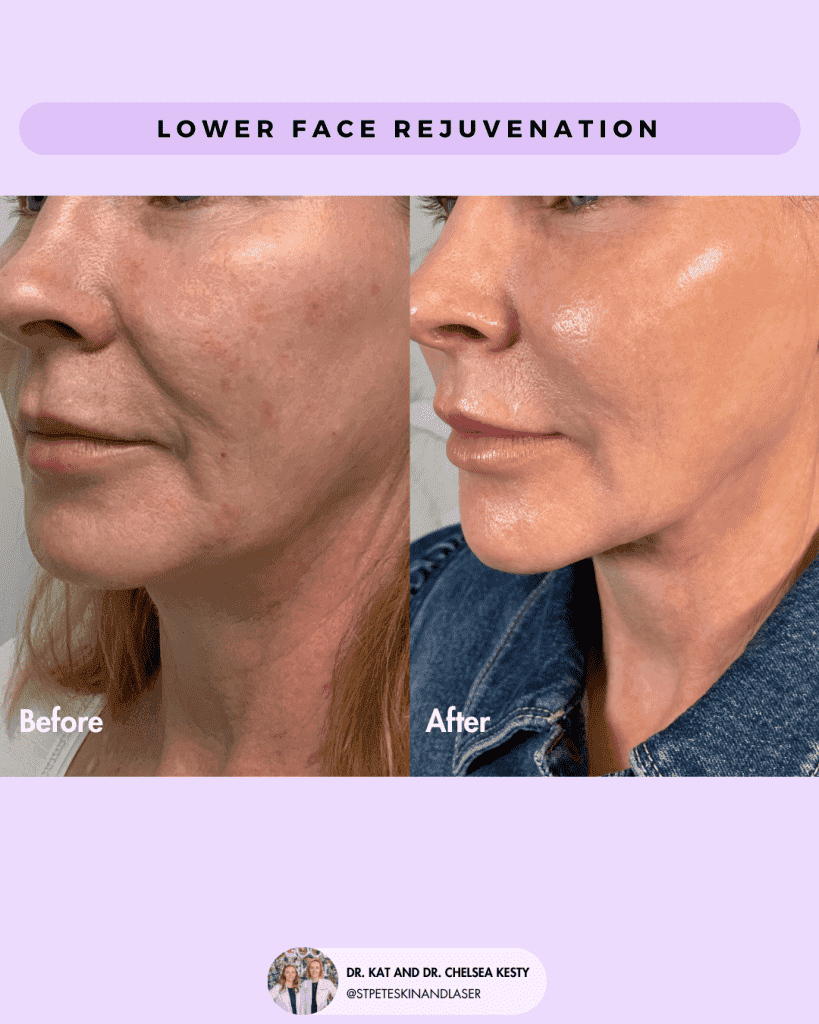 Other Cosmetic Procedures before and after results