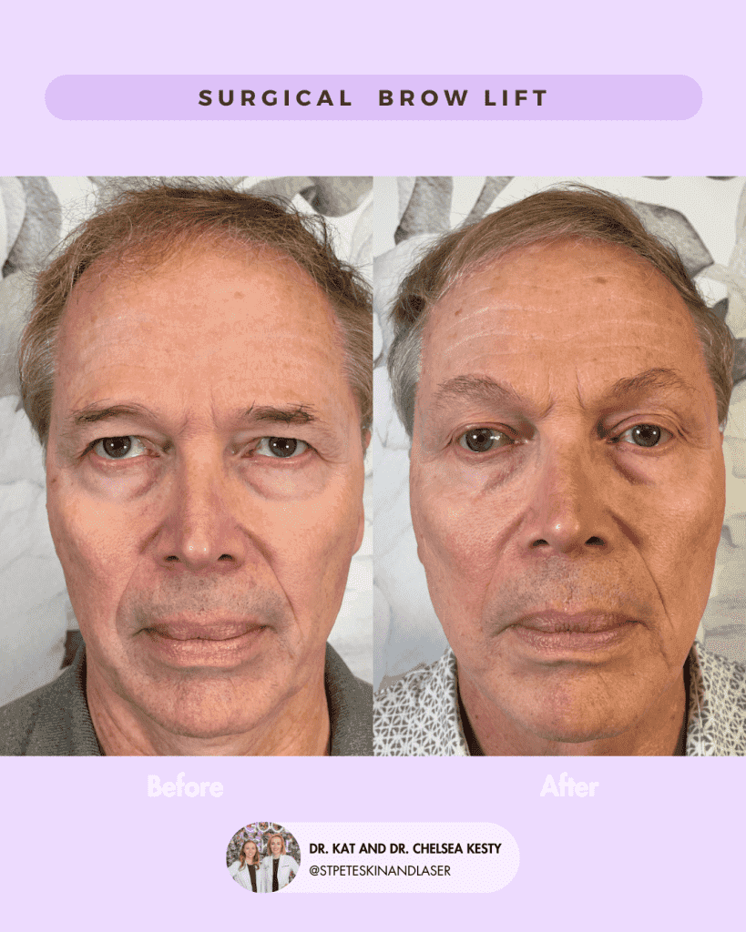 Other Cosmetic Procedures before and after results