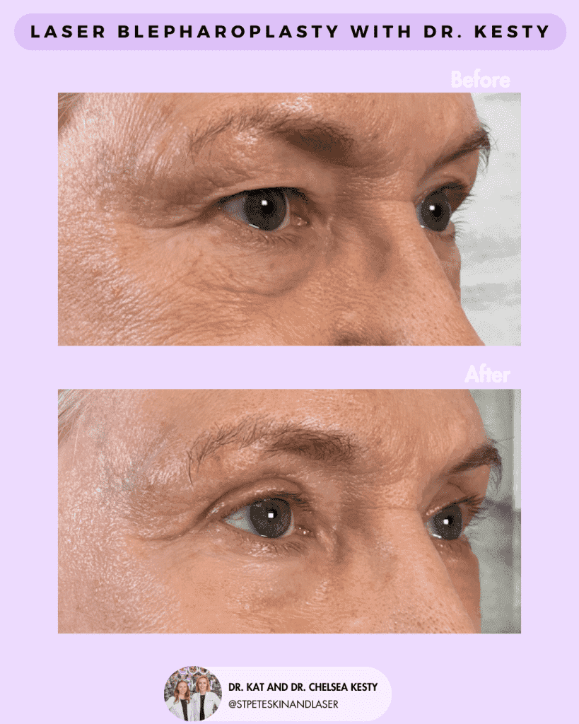 Other Cosmetic Procedures before and after results