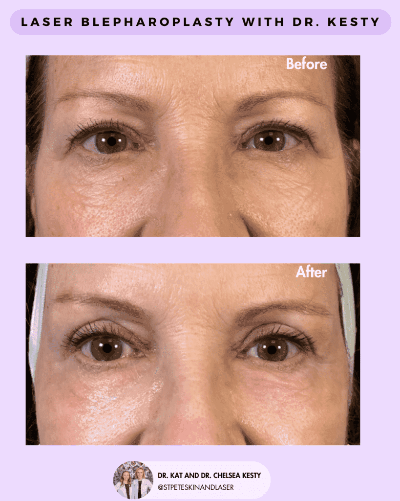 Other Cosmetic Procedures before and after results