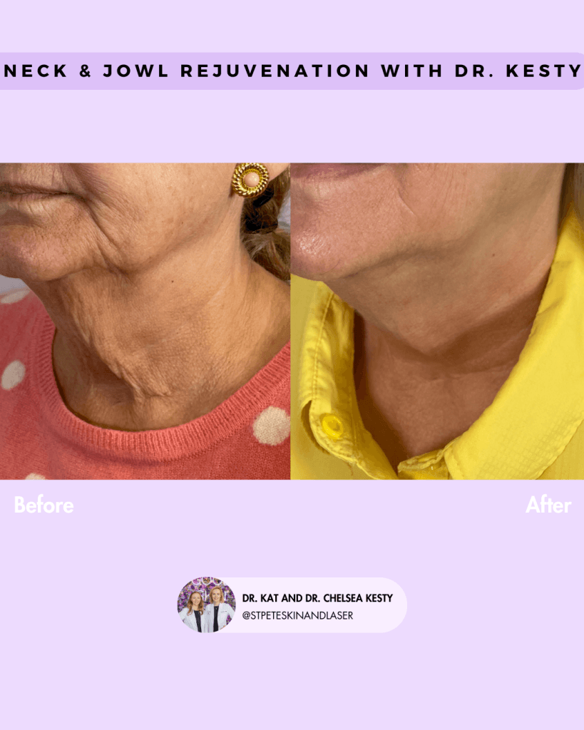 Other Cosmetic Procedures before and after results