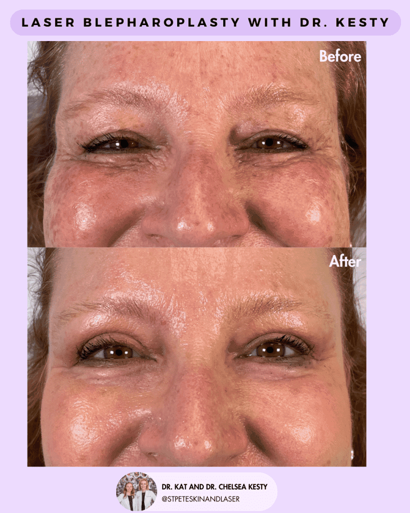 Other Cosmetic Procedures before and after results