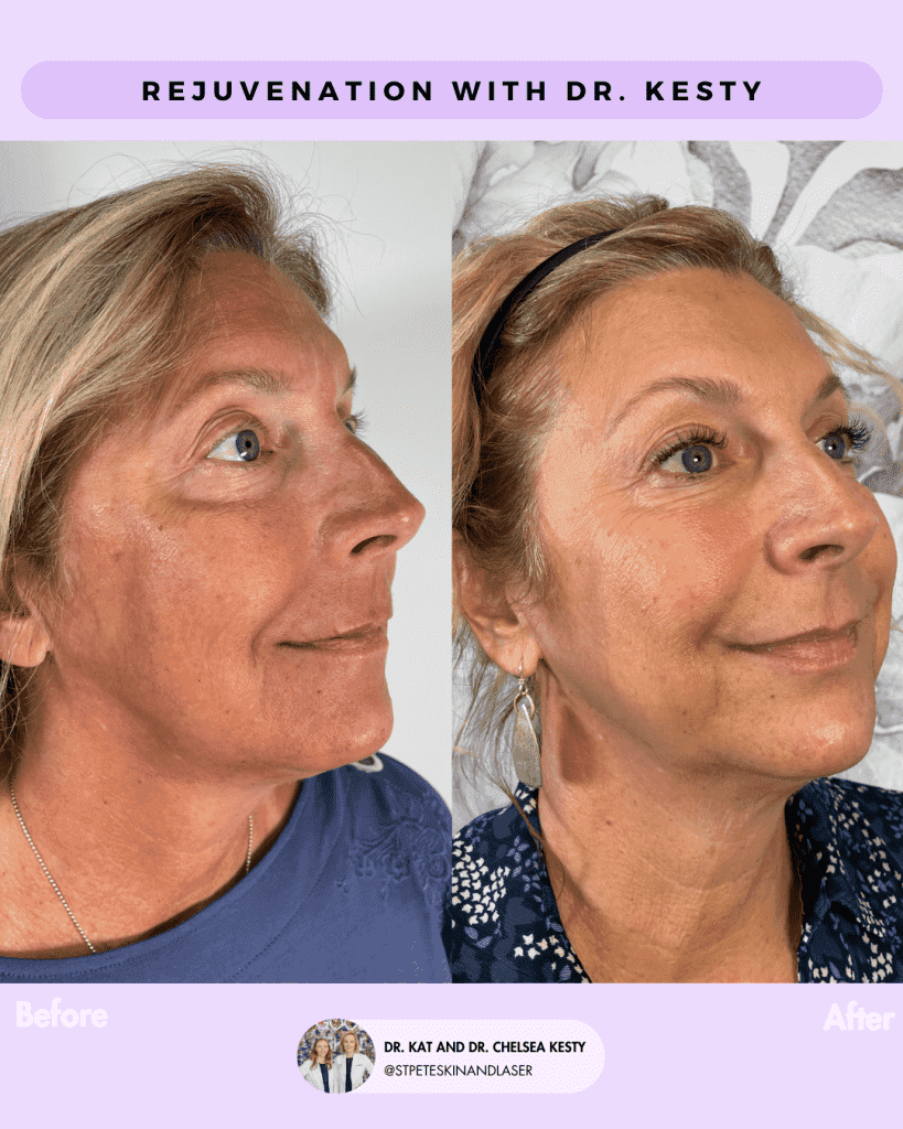 Other Cosmetic Procedures before and after results
