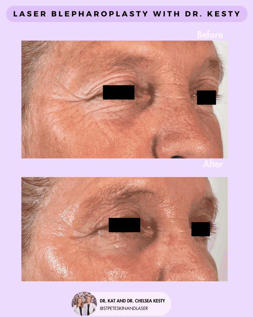 Other Cosmetic Procedures before and after results